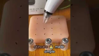 Product Link in the Comments! Pure Skin Rechargeable Blackhead Remover Machine⁠