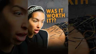 I tried Acupuncture for back pain!!!  #acupuncture #backpain #mentalhealth #holistichealth