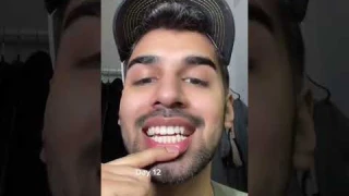 Trying a Crest Whitening strips for 20 days! #selfcare