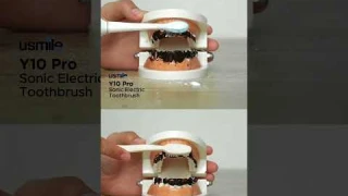 Apa benar sikat gigi elektrik lebih efektif 🤔