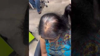 Hair Topper | Hair Extensions | Hair Thinning | Wigs | Human Hair | Beaux | Shorts