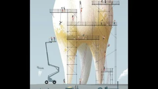 Do Teeth Whitening Kits Really Work? this is the answer