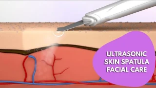 Ultrasonic Skin Spatula Facial | Ultrasonic Skin Scrubber Spatula| Blackhead Removal Exfoliation
