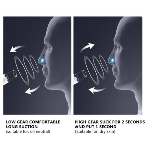 Rechargeable Electric Blackhead Remover, Home2ZY