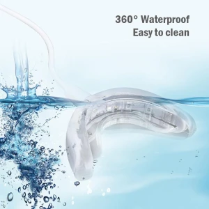 4-in-1 Teeth Whitening Kit with Timer, Margin Fades