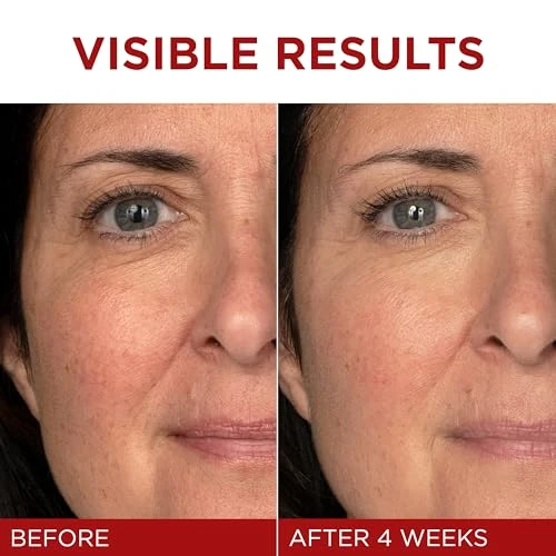 Revitalift Triple Power Anti-Aging Face Moisturizer, L'OREAL PARIS