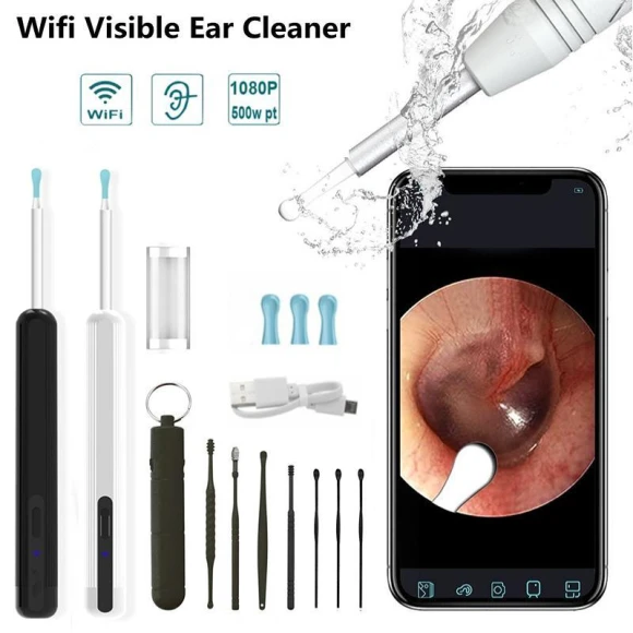 Smart Vision Wireless Ear Cleaning Spoon — Electric Ear Cleaner, Meiteai-All