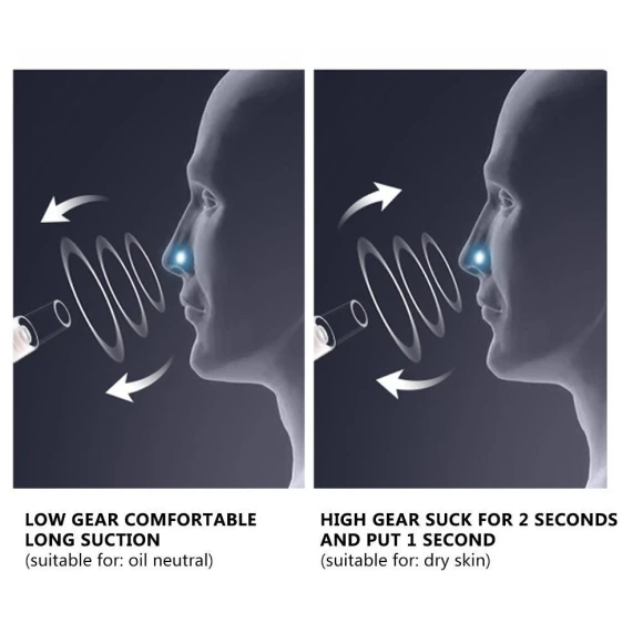 Rechargeable Electric Blackhead Remover, Home2ZY