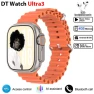 Smart Watch with AI, Amoled Display, and App Store — Smart Watch, DT