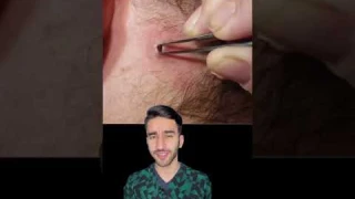 удаление неизвестного объекта