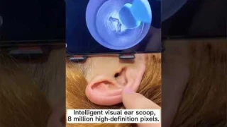 NE3 Ear Cleaner Otoscope Ear Wax Removal Tool With Camera LED Light Wireless Ear Endoscope