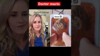 Doctor reacts: foot detox? #FactorCap🧢
