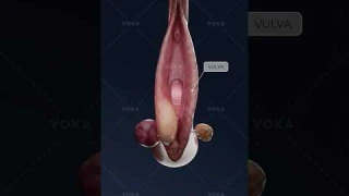 What turns a Bartholin cyst into a painful abscess? Study gynecology in 3D with VOKA