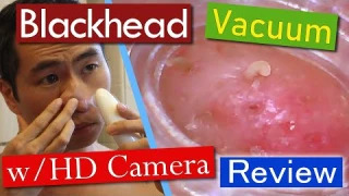 Visual Blackhead Removal Vacuum w/Built-in Camera Review
