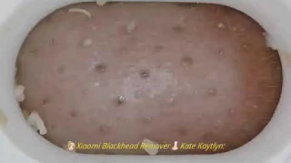 👃🏻👱🏻‍♀️Xiaomi Blackheads Remover
