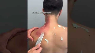 Scraping the upper traps #chiropractor #stretch #physiotherapy #fitness #backpain #workout