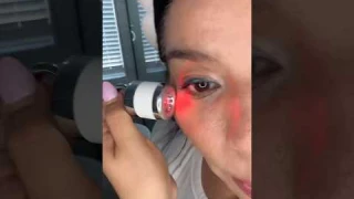 YCZ Electric Massage Eye Cream #eyecream #darkcircles #undereyecare #skincare #skincareroutine