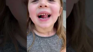 The Tooth Part 1 #shorts