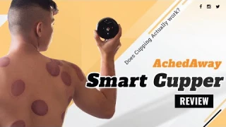 Does Cupping ACTUALLY Work? AchedAway Smart Cupper Review