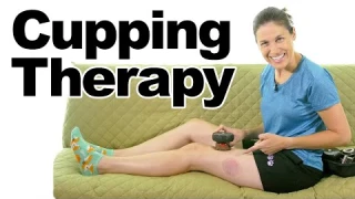 Using Cupping Therapy to Relieve Pain