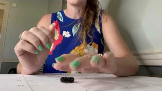 Acupressure Rings Spiky Sensory Finger Rings Stress Relief Fidget Sensory Toys Fidget Ring