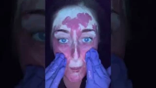 Applying SPF under LED-UV Light | Dr. Medispa