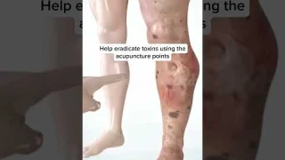 Do Foot Detox Pads Actually Work?😱😍 #shorts #footpaths #foot