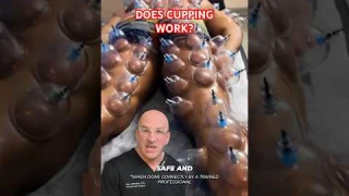 Cupping Therapy - Pain Relief or Nonsense⁉️ #shorts