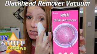 Blackhead Remover Vacuum with Built-in Camera Review