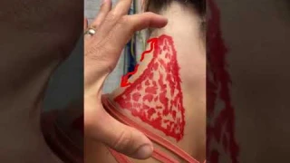 4 Releases for this Nagging Pain