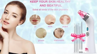 Blackhead Remover Pore Vacuum Electric Blackhead Vacuum Cleaner Blackhead