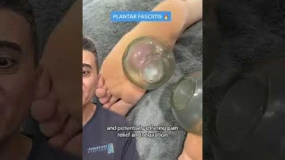 Cupping Therapy for Feet | The Ultimate Plantar Relief Technique?