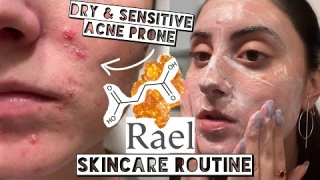 SKINCARE ROUTINE FOR ACNE, SENSETIVE, DRY SKIN | Rael Miracle Clear Succinic Acid Skincare