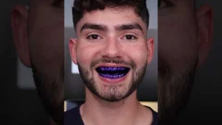 Quip Electric Toothbrush!! #shorts